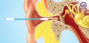 بررسی فرآیند تولید گوش پاک کن
